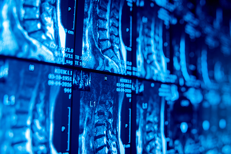 全身ドックの主な検査内容とは? どんな病気がわかるのか