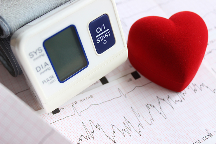 心臓にはどのような疾患があるのか？　心臓の検査項目や検査内容とは