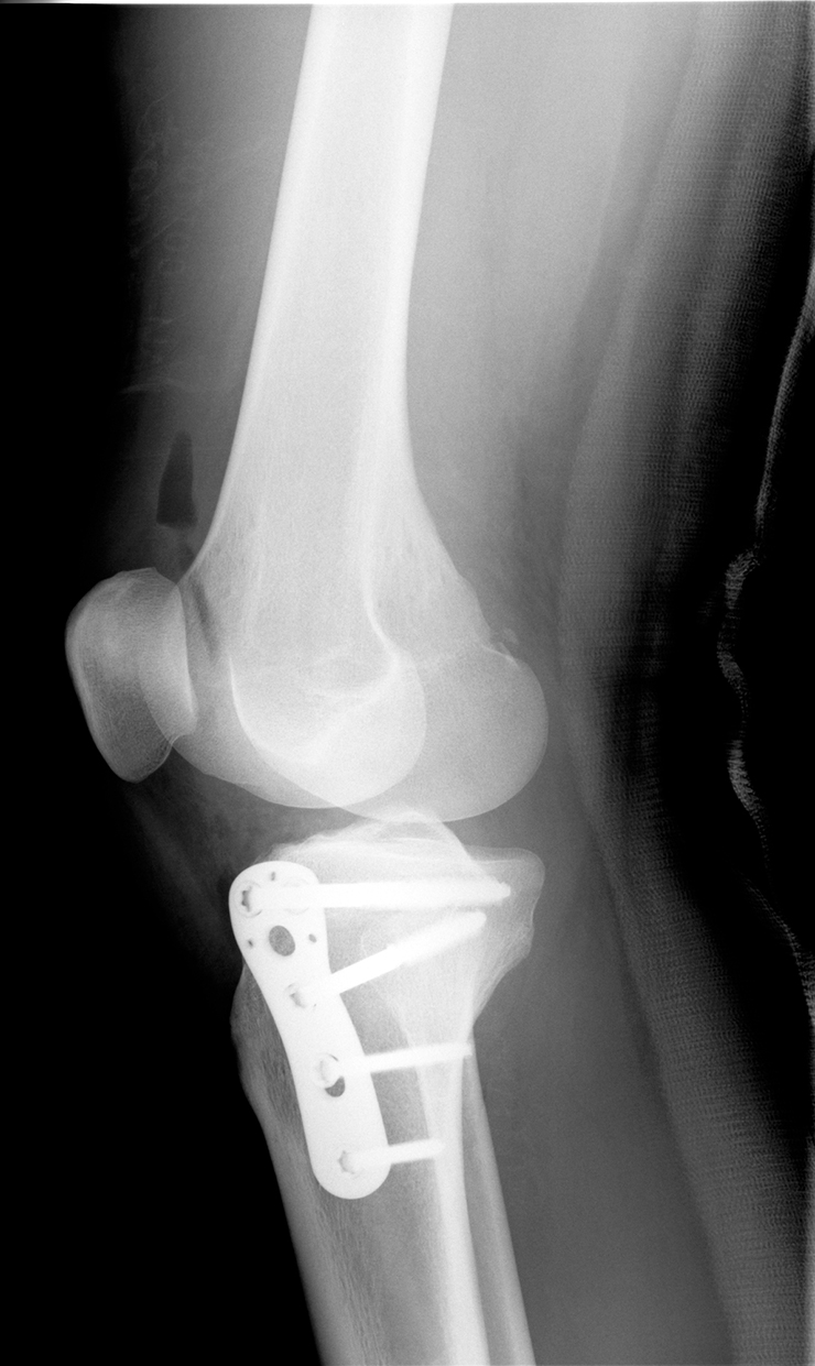 人間ドックの「MRI検査」項目を選べる人・選べない人 MRIの注意点
