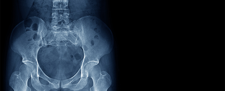 骨盤は内臓のゆりかご……レントゲン検査だけではダメな理由