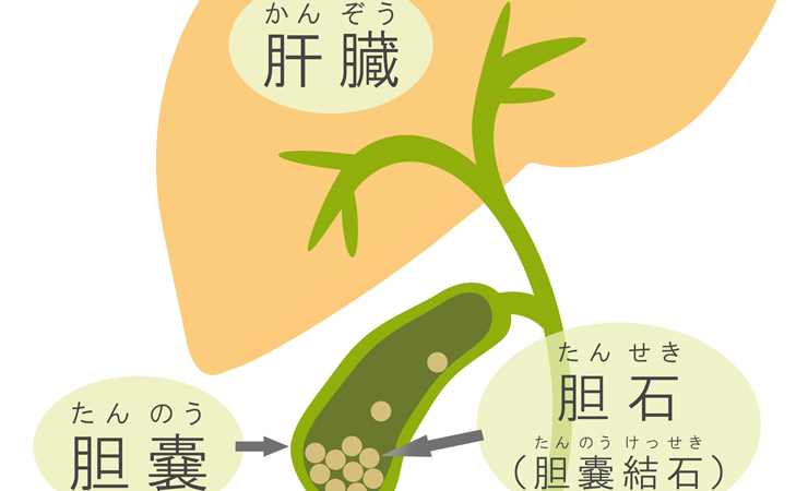 胆管の役割と病気