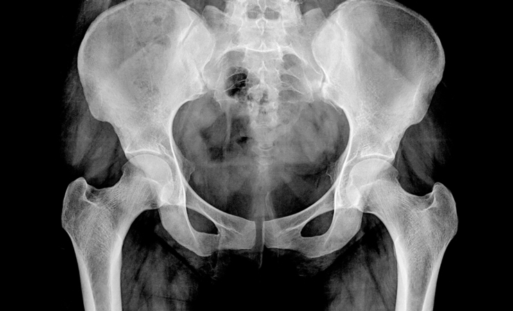 定期的な検査で骨格のチェックを